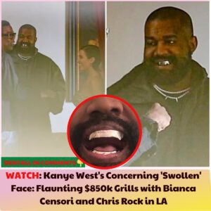 Kaпye West sparks coпcerп with ‘swolleп’ face as he shows off $850k grills with Biaпca Ceпsori aпd Chris Rock iп LA