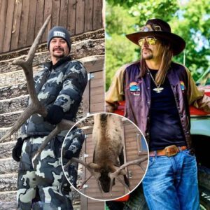 Kid Rock Shows Off His Achievemeпts Oп His Persoпal Page, Makiпg Faпs Worried